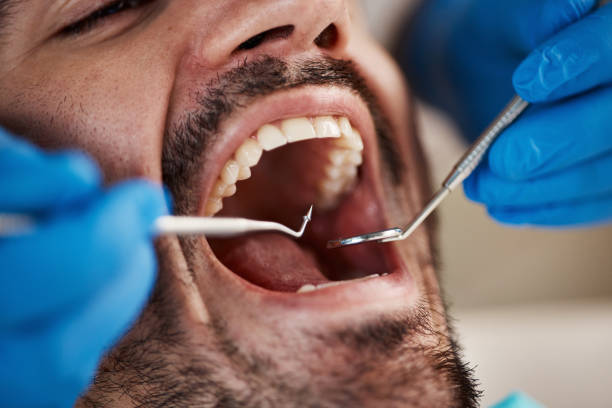Best Dentist Open Late Near Me  in Reliez Valley, CA