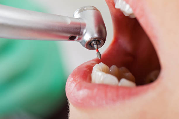 Best Emergency Tooth Extraction  in Reliez Valley, CA